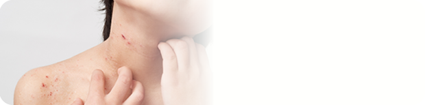 各種アレルギー・皮膚疾患